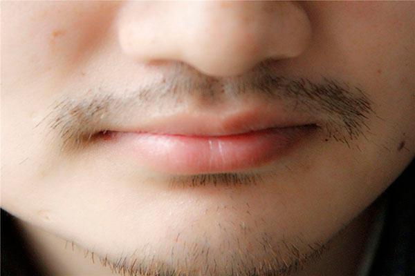 男性胡须长得快，和什么原因有关？