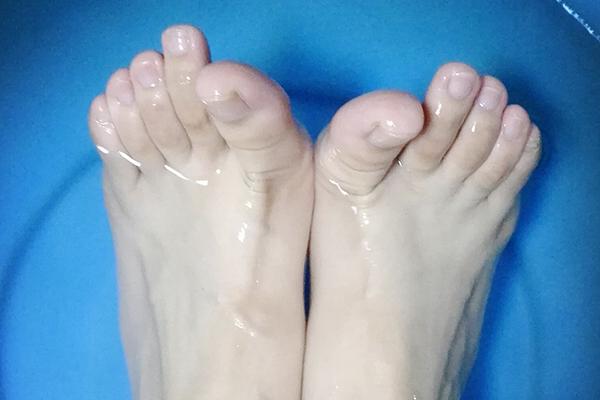 一到冬天,易出现脚后跟干裂?如何缓解?
