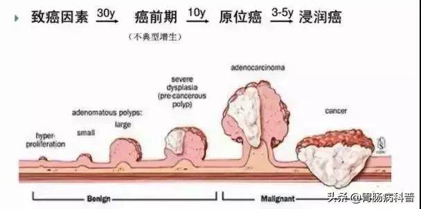 肠息肉会癌变，为什么会长肠息肉？有没有办法预防？