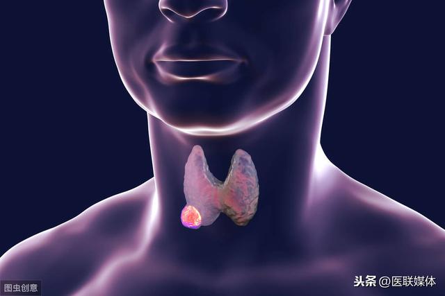 甲状腺癌来“敲门”时,身体会给出3个信号,请不要忽视