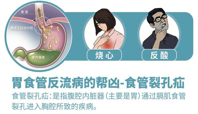慢性咽炎久治不愈,太多人忽视了这两个病因