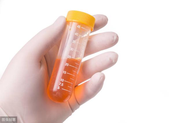 身体4个表现,说明你的尿酸太高了,控尿酸,谨记:"2多3少"