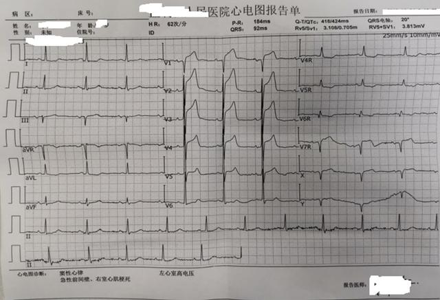 心梗、主动脉夹层傻傻分不清？3个病例帮你搞定