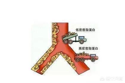 低密度脂蛋白升高,可能还没有引起你的重视