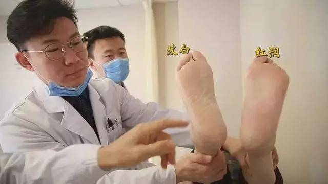 腿疼、脚麻、走不动,可能是血管堵了!教你自查风险,化险为夷