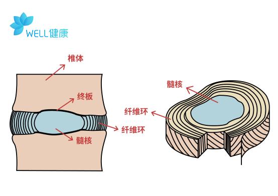 18岁就腰突了,腰突症会随着年龄增加而加剧吗?