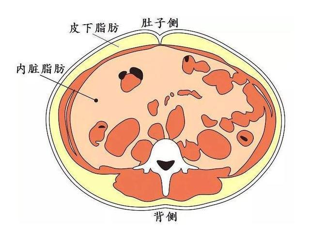内脏脂肪有多大的危害?减掉它们并不难