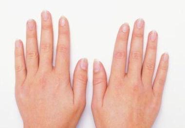 指甲的“3种”变化，饮食“6不”有助防癌
