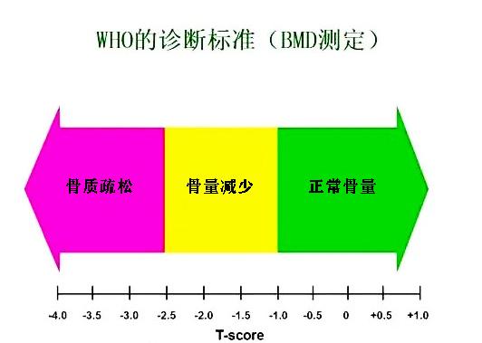 年龄大了就容易腰痛、腿疼，有些老人还容易骨折，这是为什么呢