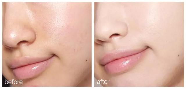 女人“敷面膜”和“不敷面膜”区别有多大?很多人还不知道