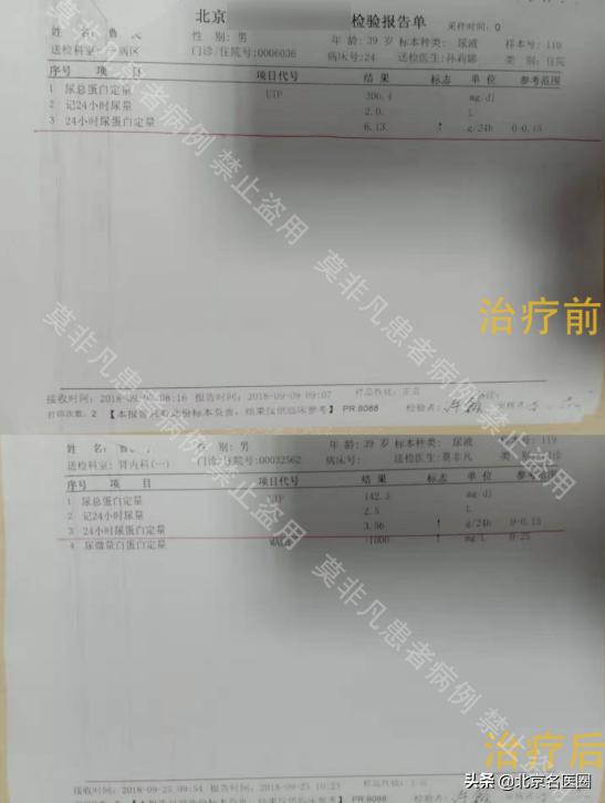 肾病综合征尿蛋白6.13g，仅仅十天就降到3.56g，怎么回事？