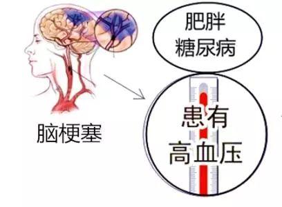 脑梗后遗症的原因有哪些？