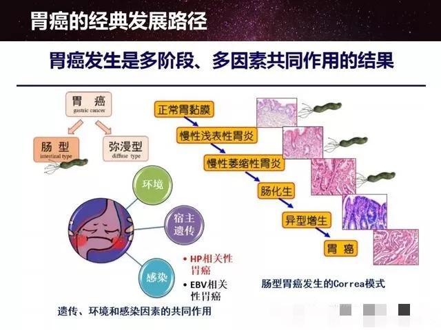 胃癌的形成需要多长时间,应该如何预防,你想知道的,这里都有