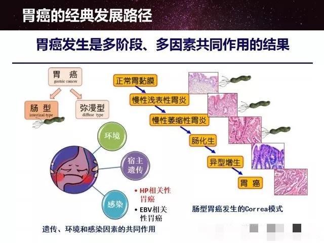 胃癌的形成需要多长时间，应该如何预防，你想知道的，这里都有