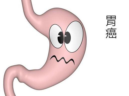 胃癌的形成需要多长时间,应该如何预防,你想知道的,这里都有