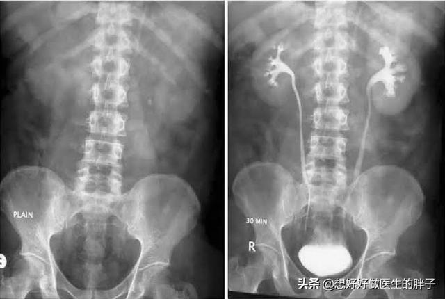 左侧腹部疼痛,常见的原因有哪些?做哪些检查可以初步诊断呢