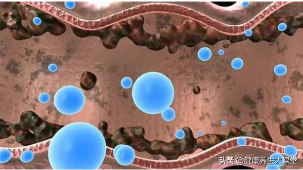 体内毒素多的人,会有这4个表现,若占3个以上,就要给身体排毒了