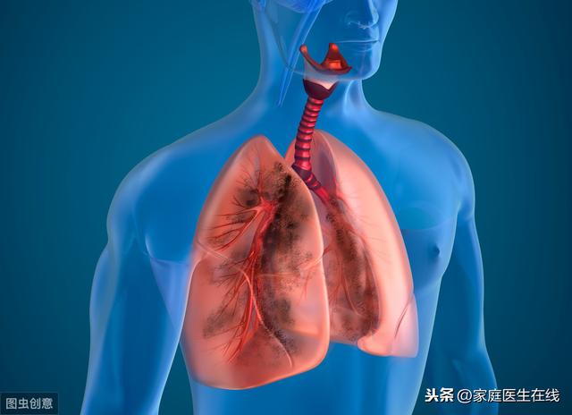 肺炎会变成肺癌吗？积极做这4件事，保护肺部健康