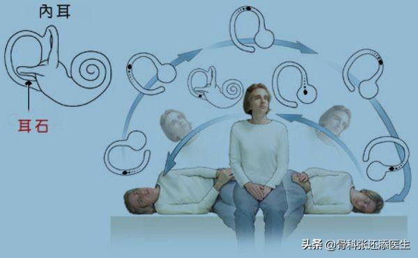 70%的颈椎病疼痛患者,盲目相信按摩,连类型都没搞清楚