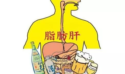 酒精肝和脂肪肝有什么区别？预防方法都有哪些？