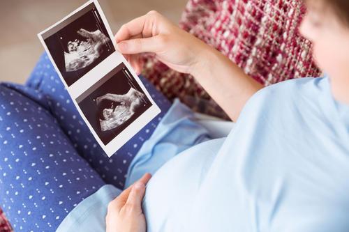 父母近视会遗传给孩子吗?想让宝宝视力好,孕期妈妈这样吃