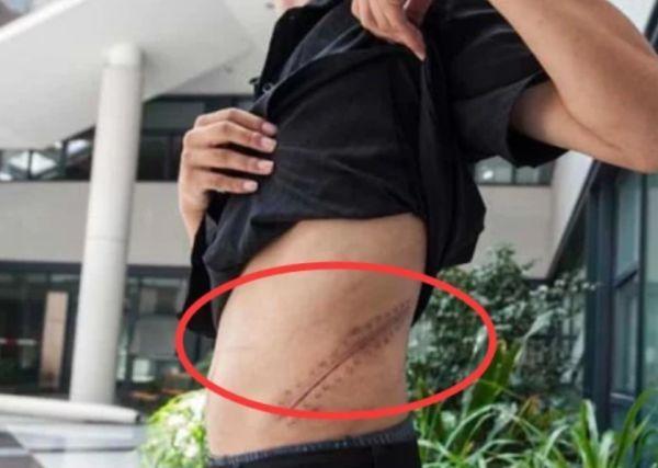 苹果现在已经烂大街了,当年为了买苹果4卖肾的高中生,今如何