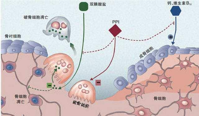 血小板减少分三型,患者饮食不可掉以轻心