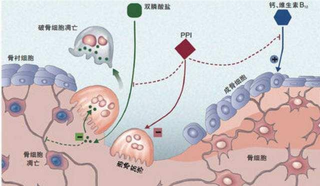 血小板减少分三型，患者饮食不可掉以轻心