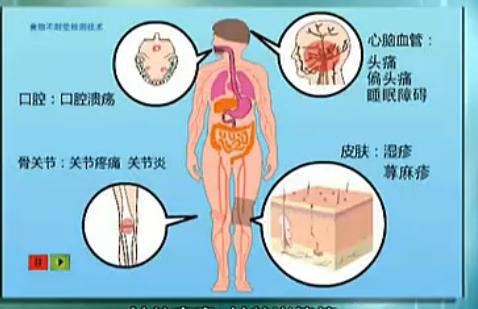 从“蛋白质不能吸收，吃什么都没用”再谈食物不耐受