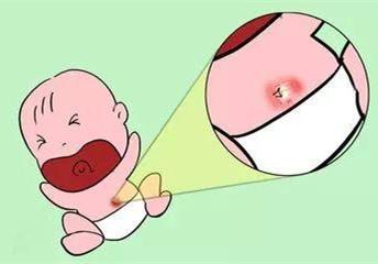 新生儿易患的10种常见疾病，如何预防，产妇早知道，宝宝少受罪！