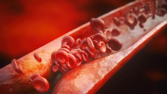 身体‘缺镁’体内发炎、心血管出状况!一张表告诉你补镁吃什么