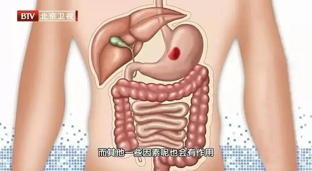 春季卒中、肿瘤高发!五个危险因素,能躲一个是一个!学会四招安度“多事之春”