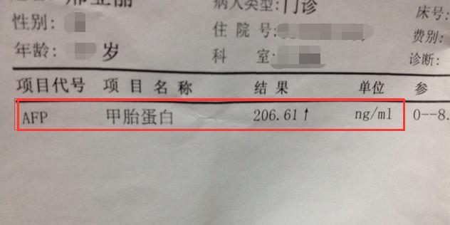 正常人的肝细胞不会产生甲胎蛋白,如果你指标偏高,当心癌变风险