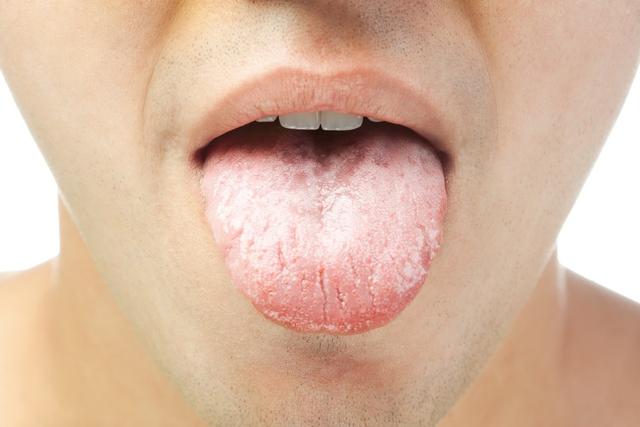 身体很虚弱、舌苔黏腻!这种情况下可以进补吗?该怎么补呢?