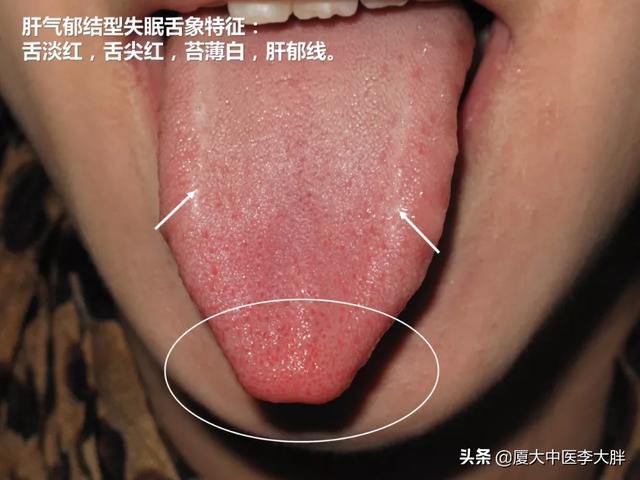 都说春眠不觉晓,为什么春天常常不好睡?医生提示春季养生这样做