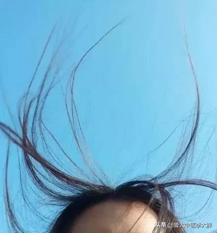 都说春眠不觉晓,为什么春天常常不好睡?医生提示春季养生这样做