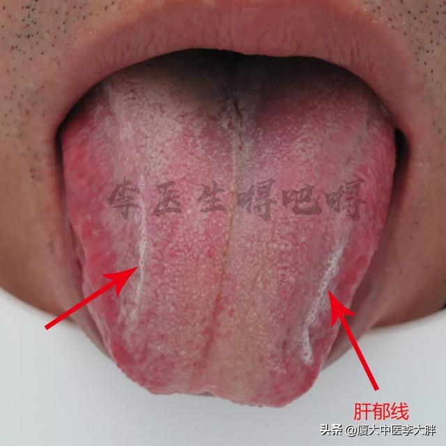 都说春眠不觉晓,为什么春天常常不好睡?医生提示春季养生这样做
