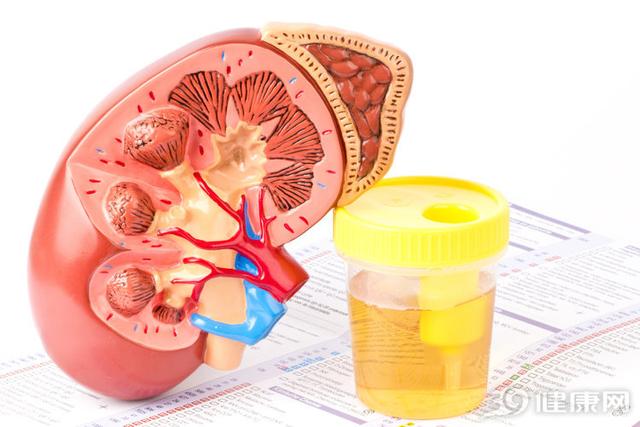 尿太多、尿色深、有夜尿，说明肾不好？关于尿的6个真相，了解下