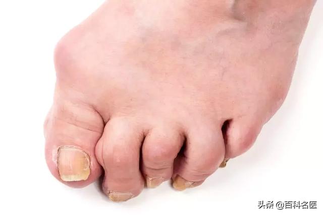 健康谣言101 哪条戳进你心窝?
