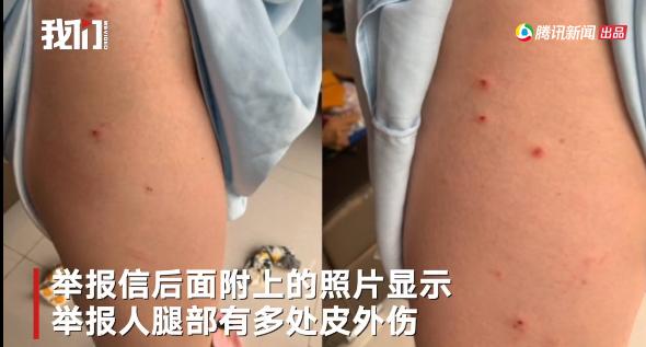 大快人心!湖南郴州北湖区涉嫌猥亵事件团委书记被免职,别用“误会”模糊法律问题