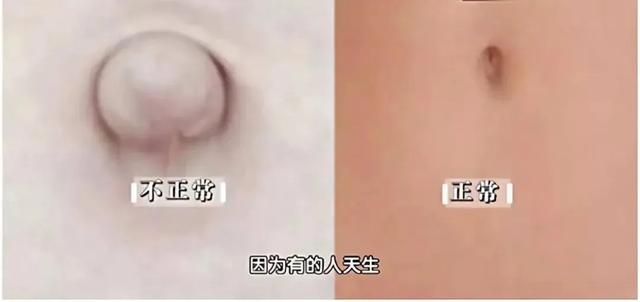 肝：最沉默的器官，如何抓住病变的蛛丝马迹？简单自查