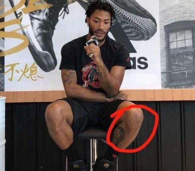 成功来之不易,看看NBA巨星的伤口,你们还羡慕吗?