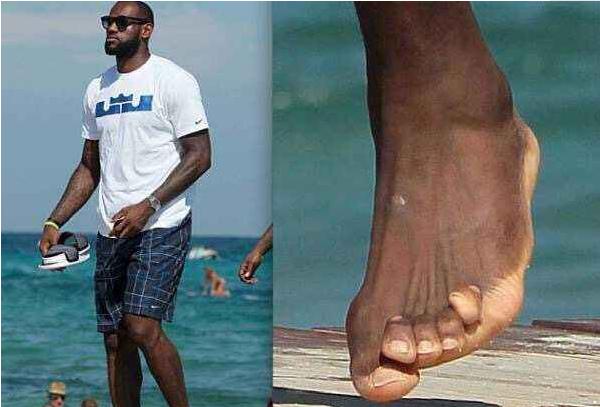 成功来之不易,看看NBA巨星的伤口,你们还羡慕吗?