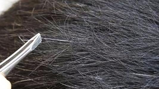 为什么年纪轻轻,白头发却越长越多?不要忽视背后的这3种原因