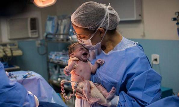 巴西女婴出生一副“臭脸”，怒瞪医护人员，网友：又有新表情包了