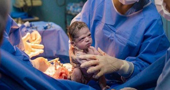 巴西女婴出生一副“臭脸”，怒瞪医护人员，网友：又有新表情包了