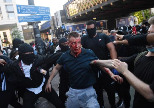 伦敦白人示威者被打得满脸鲜血，对立团体的黑人将其背到安全区域