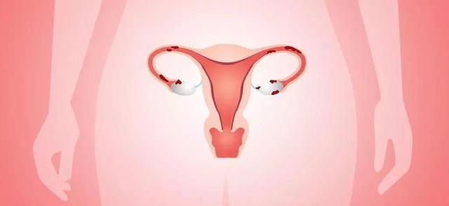 人过中年,女性怎样保健“性”?有这4种方式和2种锻炼方法