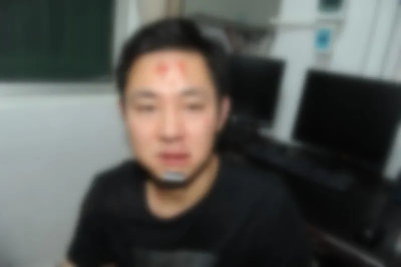 民警董鹏飞当场被撞昏迷,身上不同程度受伤