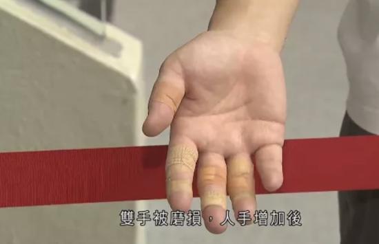 有队员双手破皮 图源:无线新闻视频截图